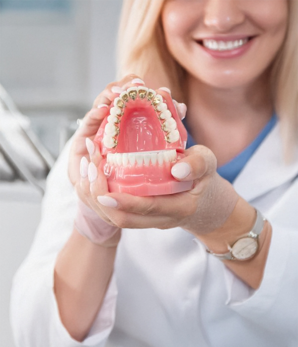 Lingual-braces