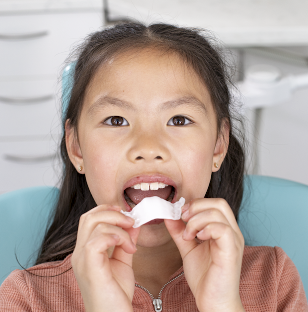 Maxillary Expander